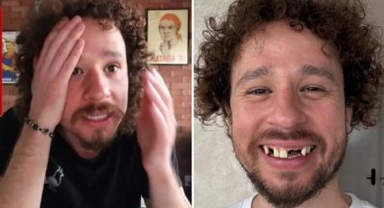 Luisito Comunica revela lo que pasó con sus dientes ¿Nos engañó a todos?