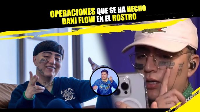 Operaciones que se ha hecho Dani Flow en el rostro ¡No solo son tatuajes!