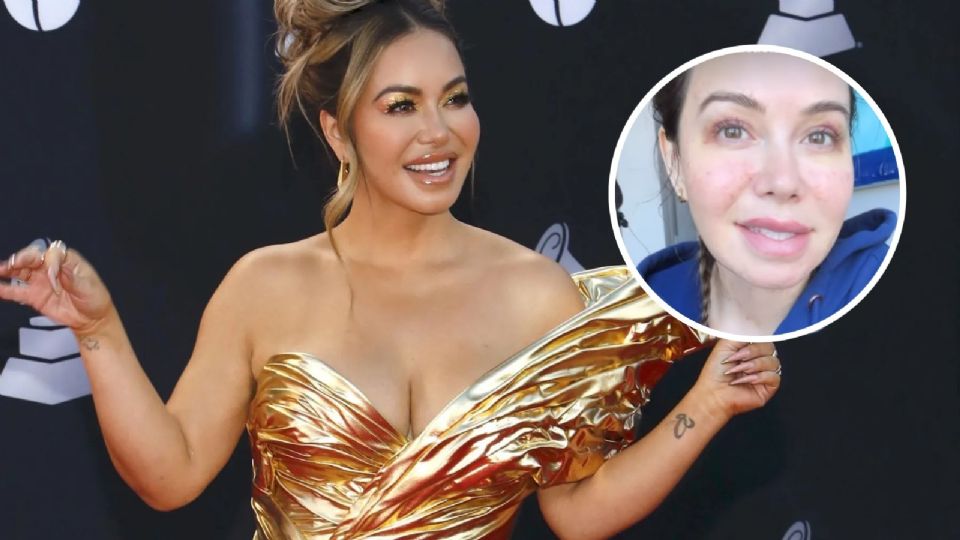 Chiquis Rivera se arregla el rostro y lo presume ¿cómo luce?