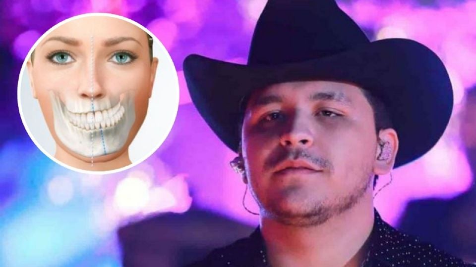 Christian Nodal preocupó a sus millones de seguidores al anunciar que había sufrió una lesión en la cara.