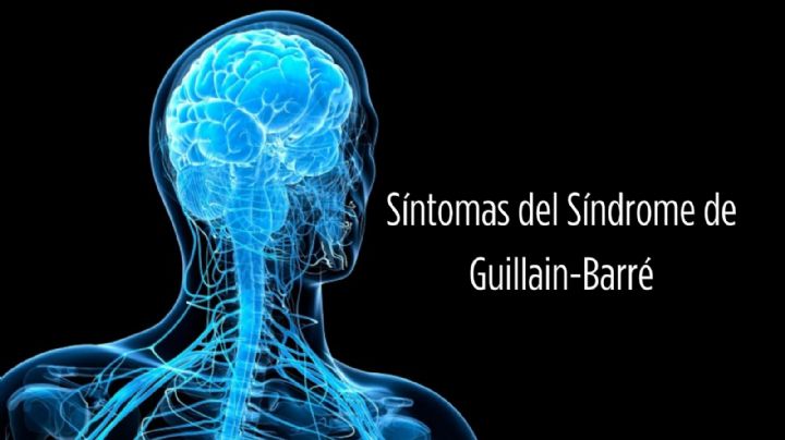 Estos son los primeros síntomas del síndrome de Guillain-Barré