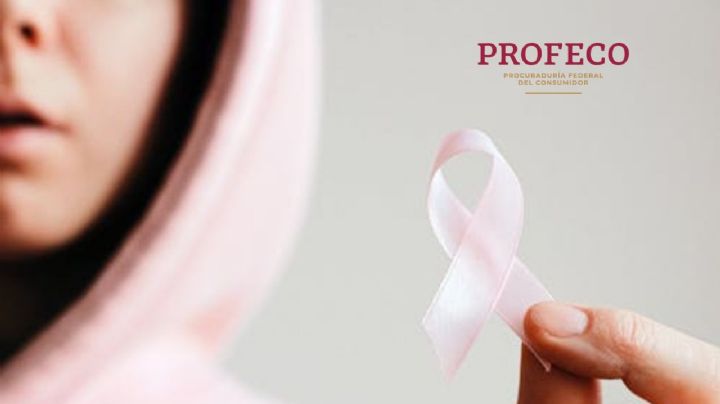 Precio de mastografía en provincia: Profeco da los más caros y baratos en Jalisco, Nuevo León y más