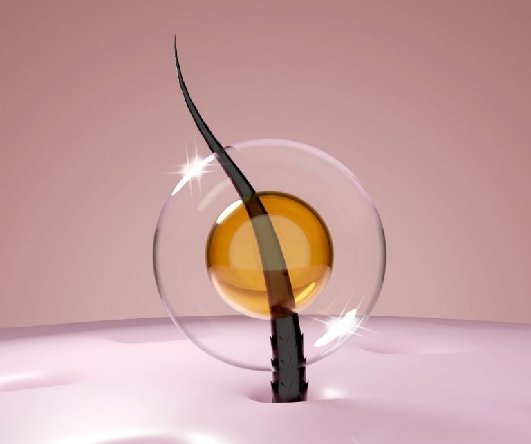 Deterioro desde la raíz