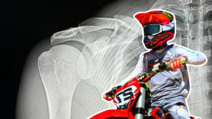 Natanael Cano sufre fractura de clavícula en accidente de motocross