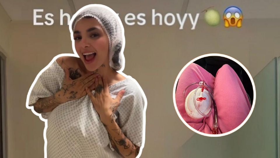 Karely Ruiz se somete a nueva cirugía estética